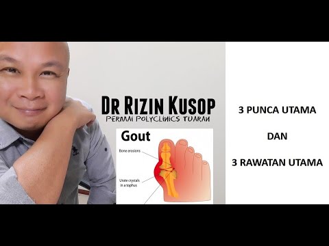 Video: Tumor otak jinak: gejala, jenis, kaedah diagnostik, terapi ubat, keperluan untuk pembedahan, prognosis