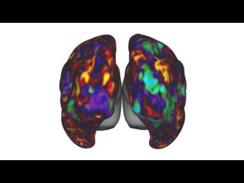 MRI Research Decoding the Human Brain