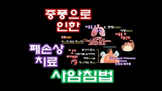 1065: 중풍으로 인한 폐(肺) 손상과 치료 사암침법