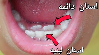 حل مشكله ظهور الاسنان الدائمه خلف الاسنان اللبنيه في الاطفال