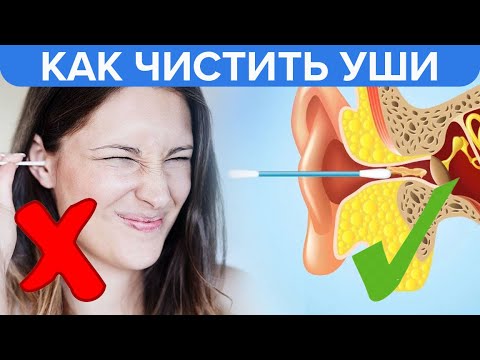 Как правильно чистить уши | Правильная гигиена ушей! - Доктор 24