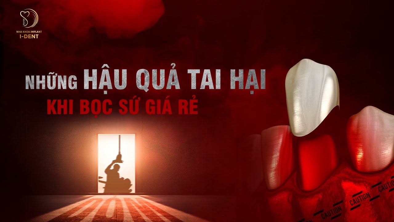 Tác hại của việc bọc sứ GIÁ RẺ