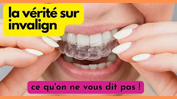 Comment avoir Invisalign gratuit