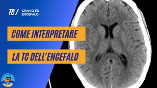 Come interpretare la TC encefalo - parte 1 (anatomia)