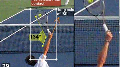 Slice Serve with Details of Internal Shoulder Rotation to Impact