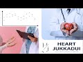 Neural Network System for Heart Disease Patient Forecasting - SWU Computer Engineer