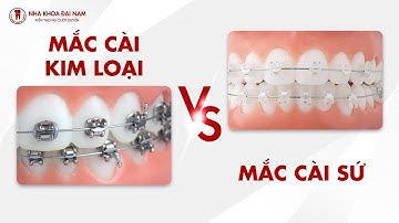 So sánh niềng răng mắc cài sứ và kim loại: Đâu là lựa chọn tốt hơn?