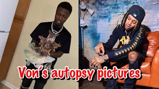 Lul Timm response to King Von’s autopsy pictures on Facebook page #llkv #4kt
