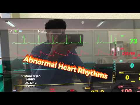 EKG Training: Watching and Interpreting the ECG  Monitor