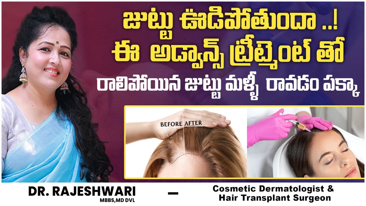Best Treatment For Hair Loss And Regrowth PRP GFC Treatment In best-treatment-for-hair-loss-and-regrowth-prp-gfc-treatment-in