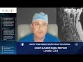 1 Level Deuk Laser Disc Repair of the Cervical Spine: C5-6
