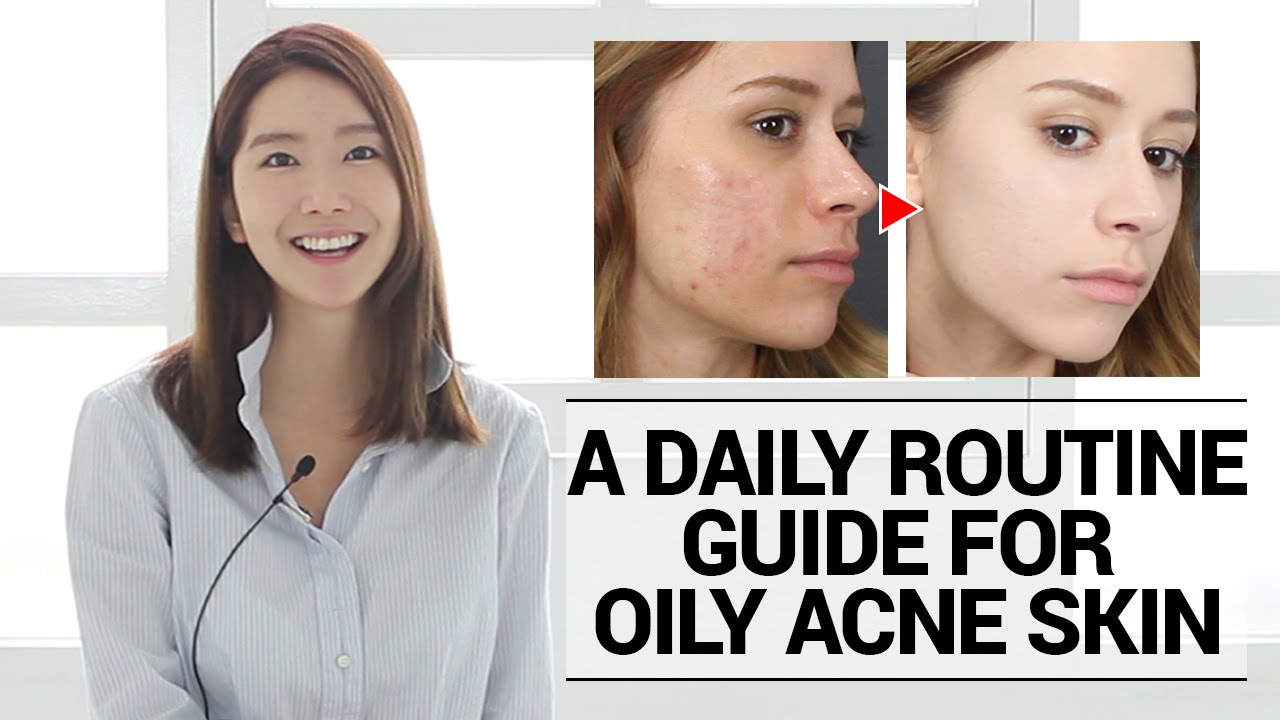 How To Cure Oily Acne Prone Skin A Daily Routine Guide Youtube 