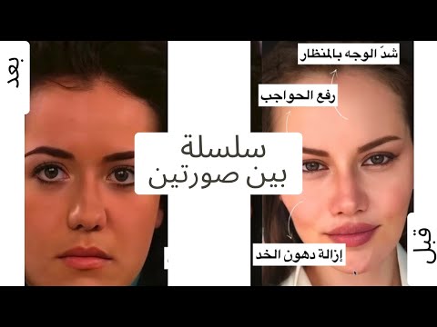 لماذا ت نكر فهرية عمليات التجميل الحقيقة كاملة 