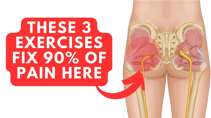 Fix 90% Of Piriformis & Glute Problems With These 3 Exercises - DayDayNews