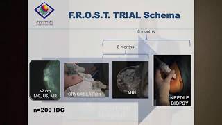 Cryoablation And The Frost Clinical Trial