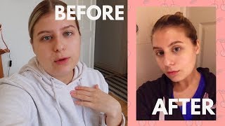 3 Day water fast! Weightloss | My thoughts | Motivation