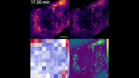 NanoJ Sup. Movie 1 - Demonstration of SRRF and SQUIRREL analysis