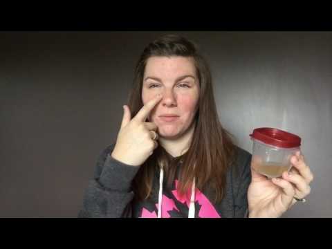 Apple Cider Vinegar Face wash - Acne and skin care