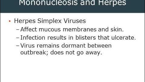 2014 02 02 17 07 AEMT Ch 28 Part 2