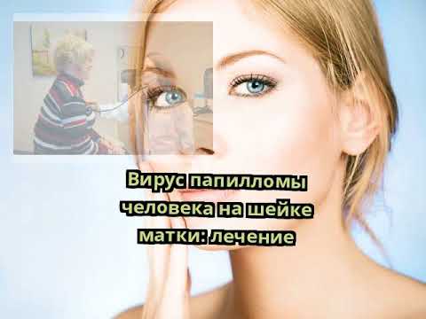 Вирус папилломы человека на шейке матки: лечение