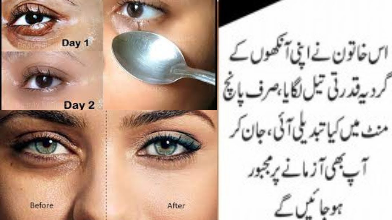 How to Remove Under Eye WRINKLES, Under Eye Bags, Puffy eyes & Dark ...