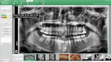 EZdent I VIEWER Tab 01 Patient Search & Windowing