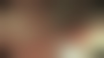 Serrated Polyps Can Be Safely and Effectively Removed by Endoscopic Mucosal Resection