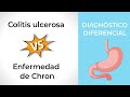 Diagnóstico Diferencial. Colitis ulcerosa vs Crohn