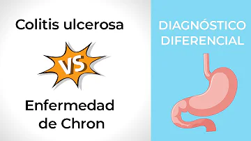 ¿Cómo distinguen los médicos entre la enfermedad de Crohn y la colitis ulcerosa?