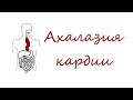 Ахалазия кардии