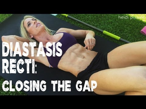 Diastasis Recti: 5 Exercises To Close the Gap for Postpartum Moms