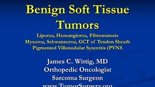 Orthopedic Oncology and Pathology Course - Benign Soft Tissue Tumors (Lipoma, etc) - Lecture 9 screenshot 5