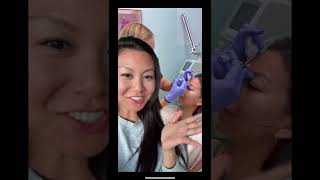 first time getting Botox!! | #shorts #botox
