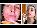 a rotina de skincare que mudou minha pele em 3 meses *sem pegadinhas*