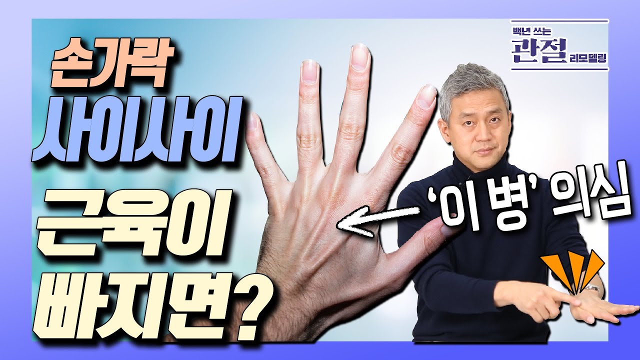 온 몸에 힘이없고, 식욕도 없다면? 부신기능저하증일 수 있습니다