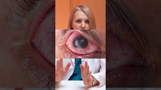 Поможет ли операция при катаракте? Можно ли восстановить зрение? #здоровье #зрение #глаза #катаракта
