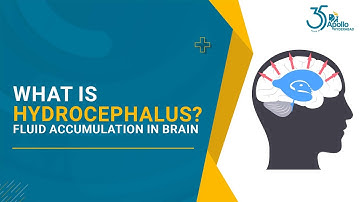 Fluid Accumulation in Brain | #Hydrocephalus | Dr Taran Vora, Neurosurgeon | Apollo Hospitals, Hyd