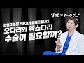 (*Eng) 휜다리 교정, 꼭 수술이 필요할까? (Feat. 오다리와 엑스다리)