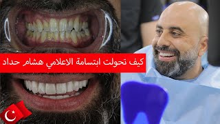 تجربة الأعلامي هشام حداد في عيادة ميديكو كلينك لتجميل الأسنان في اسطنبول