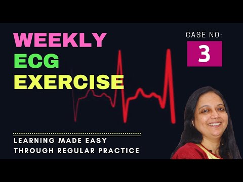 Weekly ECG Exercise- case 3