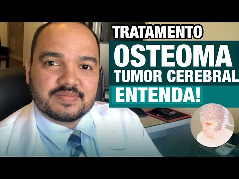 Vídeo: A remoção do osteoma da testa é coberta pelo seguro?