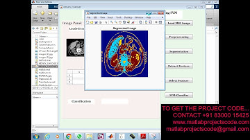 Automated Sensing of Chronic Kidney Disease Using SVM