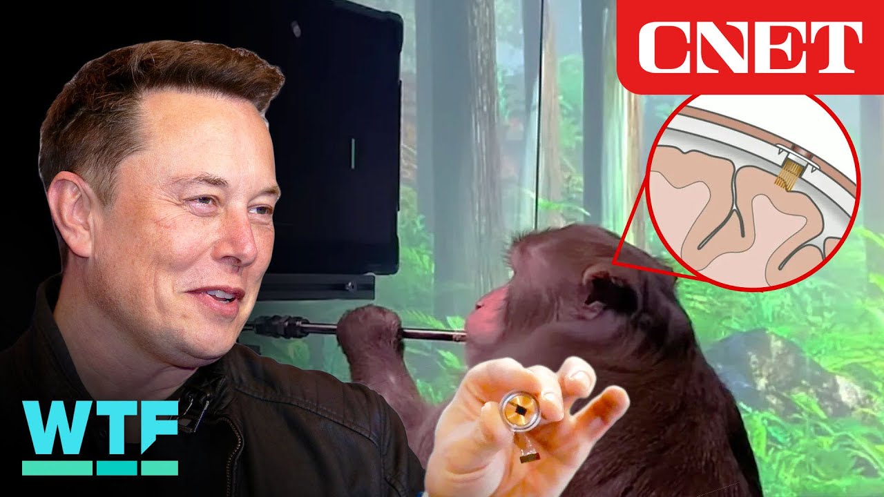 Neuralink: Everything to Know About Elon Musk's Brain Chip