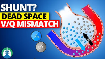 Shunt vs. Dead Space vs. V/Q Mismatch | EXPLAINED