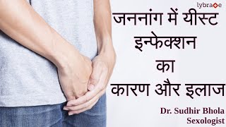 जननांग में यीस्ट इन्फेक्शन के कारण और इलाज | Causes and Treatment of Genital Infection | Dr. Sudhir