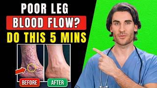 Poor Leg Circulation? Try This 30-Second Test + 3 Fast Exercises to Boost Blood Flow | Dr. James