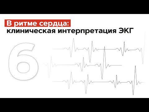 Видео: Как диагностировать сердечную недостаточность: 15 шагов (с изображениями)