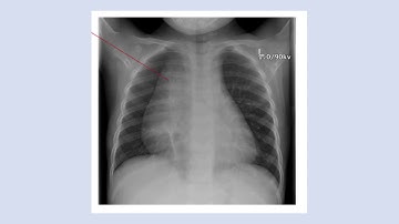 Introduction to Paediatric Oncology part 1