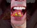 Satisfying Chewing ASMR #Compilation #ASMR #DoctorTristanPeh