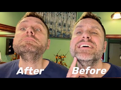 Easiest way for men to remove gray on the beard! - YouTube